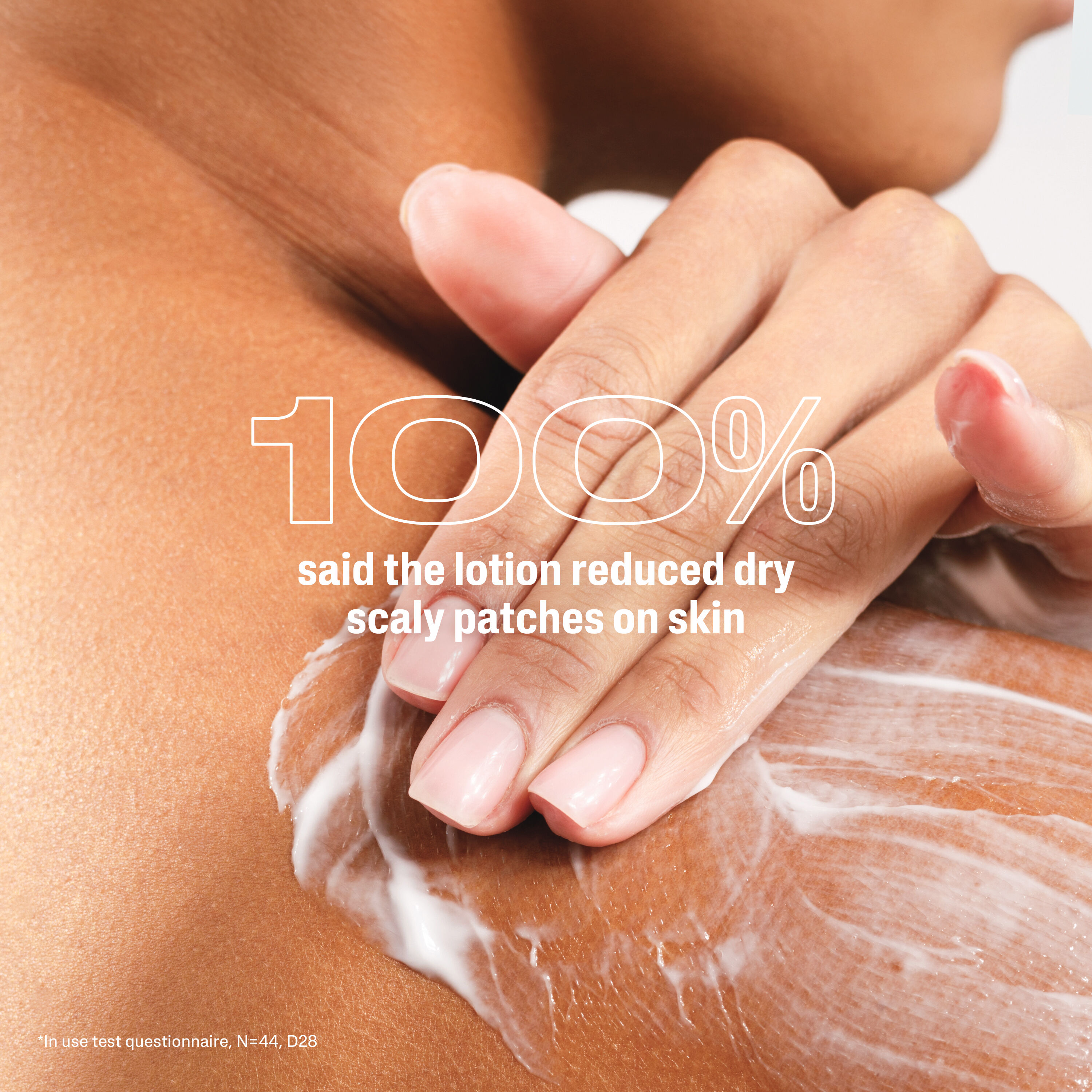 Cetaphil PRO AD Derma Skin Restoring Body Moisturiser