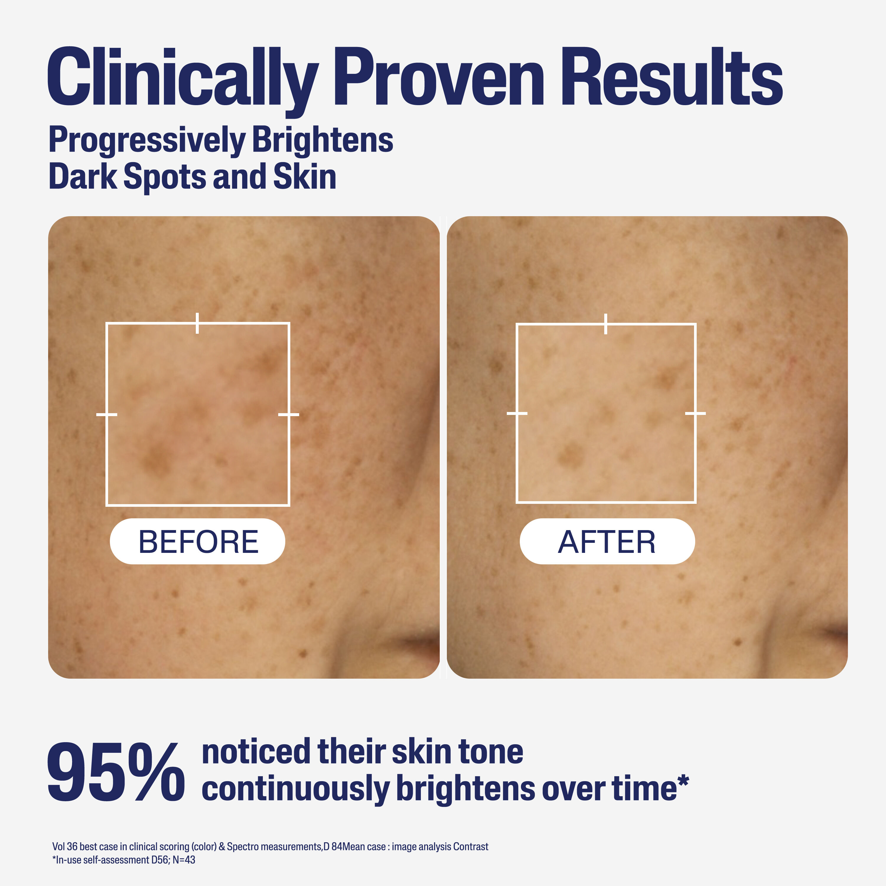Cetaphil Bright Healthy Radiance Perfecting Serum